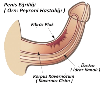 Op. Dr. Erdem Özbek | Üroloji Uzmanı | Penis büyütme